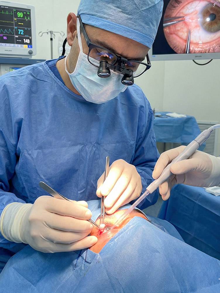 Operacija pterigijuma